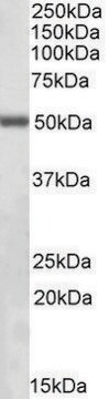 Anti-ILK (C-terminal) antibody produced in goat affinity isolated antibody, buffered aqueous solution