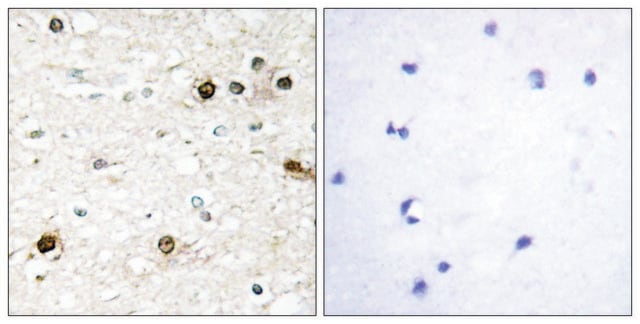 Anti-NAB2 antibody produced in rabbit affinity isolated antibody