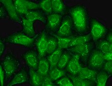Monoclonal Anti-KCNT1 antibody produced in mouse clone S3-26, 1&#160;mg/mL, purified immunoglobulin
