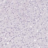 Anti-PLS1 antibody produced in rabbit Prestige Antibodies&#174; Powered by Atlas Antibodies, affinity isolated antibody, buffered aqueous glycerol solution