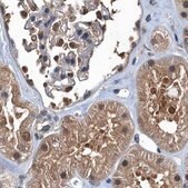 Anti-RNH1 antibody produced in rabbit Prestige Antibodies&#174; Powered by Atlas Antibodies, affinity isolated antibody, buffered aqueous glycerol solution