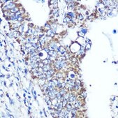 Anti-ATP5A1 antibody produced in rabbit
