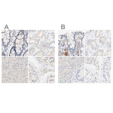 Anti-MANEA antibody produced in rabbit Ab2, Prestige Antibodies&#174; Powered by Atlas Antibodies, affinity isolated antibody, buffered aqueous glycerol solution