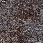 Monoclonal Anti-CD5 antibody produced in mouse Prestige Antibodies® Powered by Atlas Antibodies, clone CL12334, purified immunoglobulin, buffered aqueous glycerol solution