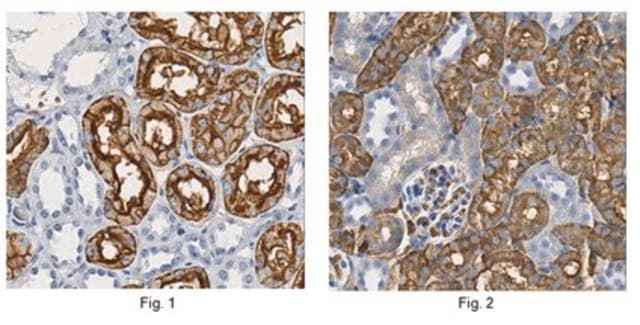 Anti-Aquaporin 1 Antibody 1.0&#160;mg/mL, Chemicon&#174;