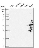 Anti-GIMAP1 antibody produced in rabbit Prestige Antibodies&#174; Powered by Atlas Antibodies, affinity isolated antibody