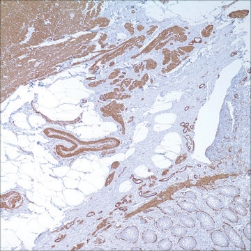 Actin, Smooth Muscle (1A4) Mouse Monoclonal Antibody