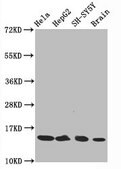 Anti-acetyl-Histone H3.1 (K14)antibody, clone 3H3, Rabbit Monoclonal recombinant, expressed in HEK293F cells