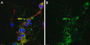 Anti-Aggrecan Core Protein Antibody, clone Cat-315