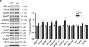 Anti-NR2A Antibody Upstate®, from rabbit
