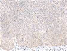 Anti-KLRC3 affinity isolated antibody
