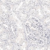 Anti-MLANA antibody produced in mouse Prestige Antibodies&#174; Powered by Atlas Antibodies, clone CL12864, purified by using Protein A, buffered aqueous glycerol solution