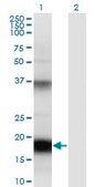 Monoclonal Anti-UBD antibody produced in mouse clone 7D8, purified immunoglobulin, buffered aqueous solution