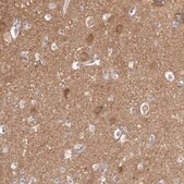 Anti-GDA antibody produced in rabbit Prestige Antibodies&#174; Powered by Atlas Antibodies, affinity isolated antibody, buffered aqueous glycerol solution