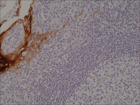 Anti-Cytokeratin 4 (CK-4) antibody, Rabbit monoclonal recombinant, expressed in HEK 293 cells, clone RM355, purified immunoglobulin
