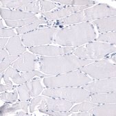 Monoclonal Anti-GAP43 antibody produced in mouse Prestige Antibodies® Powered by Atlas Antibodies, clone CL10884, purified antibody (Protein A)