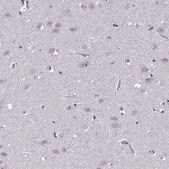 Anti-CNGB3 antibody produced in rabbit Prestige Antibodies® Powered by Atlas Antibodies, affinity isolated antibody