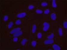 HIF1-alpha and phospho-MCM2[S40/S41] PLA&#174; Antibody Kit Powered by Bethyl Laboratories, Inc.