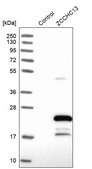 Anti-ZCCHC13 antibody produced in rabbit Prestige Antibodies&#174; Powered by Atlas Antibodies, affinity isolated antibody, buffered aqueous glycerol solution