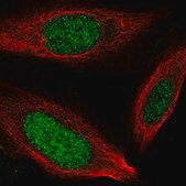 Anti-NCAPH2 antibody produced in rabbit Prestige Antibodies&#174; Powered by Atlas Antibodies, affinity isolated antibody