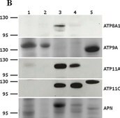 Anti-ATP11A antibody produced in rabbit Prestige Antibodies® Powered by Atlas Antibodies, affinity isolated antibody, buffered aqueous glycerol solution