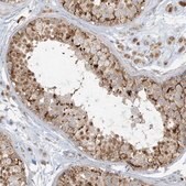 Anti-MCAT antibody produced in rabbit Prestige Antibodies&#174; Powered by Atlas Antibodies, affinity isolated antibody, buffered aqueous glycerol solution