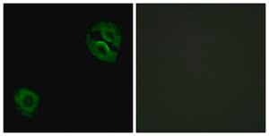 Anti-Collagen XIX &#945;1 antibody produced in rabbit affinity isolated antibody
