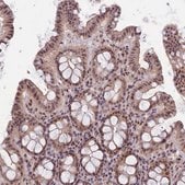 Anti-TCOF1 antibody produced in rabbit Prestige Antibodies&#174; Powered by Atlas Antibodies, affinity isolated antibody, buffered aqueous glycerol solution