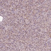 Anti-NDUFB4 antibody produced in rabbit Prestige Antibodies&#174; Powered by Atlas Antibodies, affinity isolated antibody, buffered aqueous glycerol solution