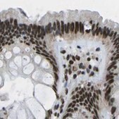 Anti-NSRP1 antibody produced in rabbit Prestige Antibodies&#174; Powered by Atlas Antibodies, affinity isolated antibody, buffered aqueous glycerol solution