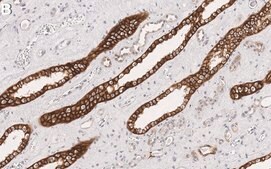 Anti-Raf-1 Antibody, clone 1I3 ZooMAb® Rabbit Monoclonal recombinant, expressed in HEK 293 cells