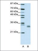 Anti-CLIC5 antibody produced in rabbit affinity isolated antibody