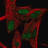Anti-RORB antibody produced in rabbit Prestige Antibodies® Powered by Atlas Antibodies, affinity isolated antibody, buffered aqueous glycerol solution