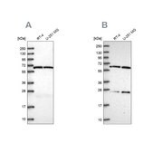 Anti-ACAD9 antibody produced in rabbit Prestige Antibodies® Powered by Atlas Antibodies, affinity isolated antibody, buffered aqueous glycerol solution