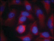 Anti-PAK1 (Ab-212) antibody produced in rabbit affinity isolated antibody