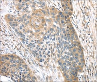 Anti-TMPRSS11A affinity isolated antibody