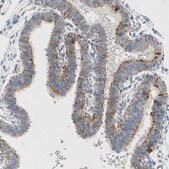 Anti-PIK3CA antibody produced in rabbit Prestige Antibodies&#174; Powered by Atlas Antibodies, affinity isolated antibody, buffered aqueous glycerol solution