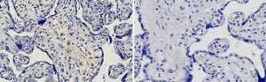 Anti-DKK1 Antibody, clone 1N16 ZooMAb® Rabbit Monoclonal recombinant, expressed in HEK 293 cells