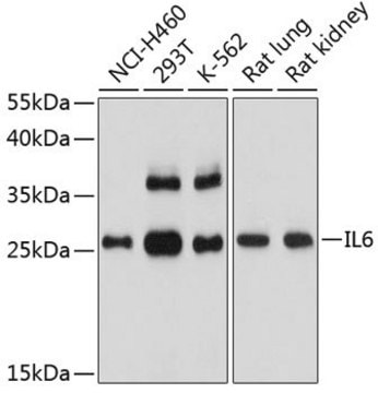 Anti-IL6 antibody produced in rabbit
