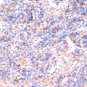 Anti-IL6 antibody produced in rabbit