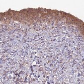 Anti-GIPC1 antibody produced in rabbit Prestige Antibodies&#174; Powered by Atlas Antibodies, affinity isolated antibody, buffered aqueous glycerol solution