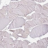 Anti-LPIN2 antibody produced in rabbit Prestige Antibodies&#174; Powered by Atlas Antibodies, affinity isolated antibody, buffered aqueous glycerol solution