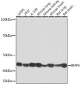 Anti-BMP6 Antibody, clone 6N5S9, Rabbit Monoclonal