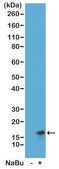 Anti-Acetyl-Histone H3 (Lys27) antibody, Rabbit monoclonal recombinant, expressed in HEK 293 cells, clone RM172, purified immunoglobulin