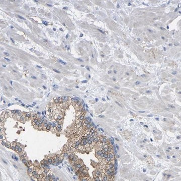 Anti-CMTM1 antibody produced in rabbit Prestige Antibodies&#174; Powered by Atlas Antibodies, affinity isolated antibody, buffered aqueous glycerol solution