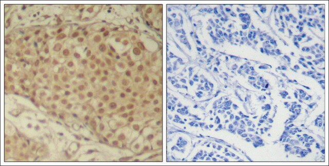 Anti-SMAD2 (Ab-220) antibody produced in rabbit affinity isolated antibody