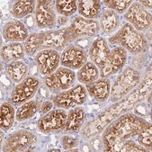 Anti-AGTRAP antibody produced in rabbit Prestige Antibodies&#174; Powered by Atlas Antibodies, affinity isolated antibody, buffered aqueous glycerol solution