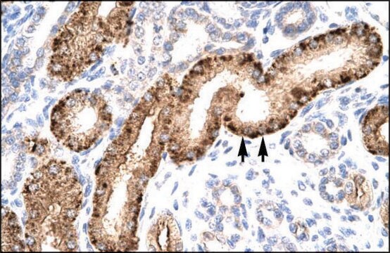 Anti-NR5A1 antibody produced in rabbit affinity isolated antibody