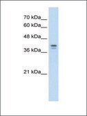 Anti-LOR IgG fraction of antiserum