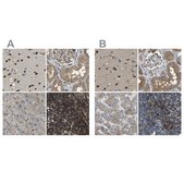 Anti-ATP8B1 antibody produced in rabbit Prestige Antibodies® Powered by Atlas Antibodies, affinity isolated antibody, buffered aqueous glycerol solution, Ab1